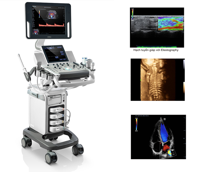 Máy siêu âm mindray dc39