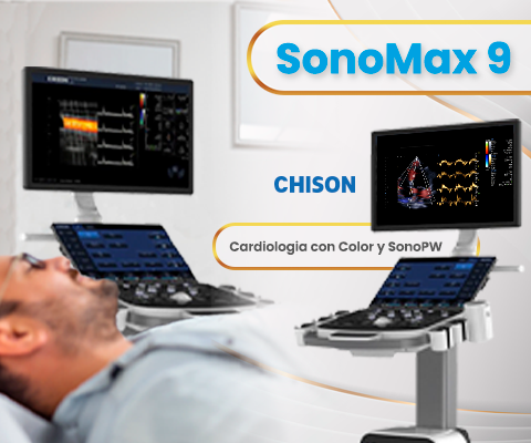 Chison SonoMax Giải Pháp Siêu Âm Đỉnh Cao