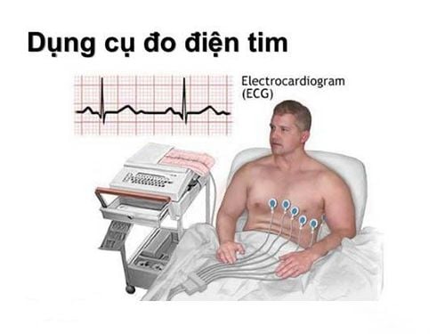 Máy Đo Điện Tim ECG Công Nghệ và Tầm Quan Trọng Trong Chẩn Đo Tim Mạch