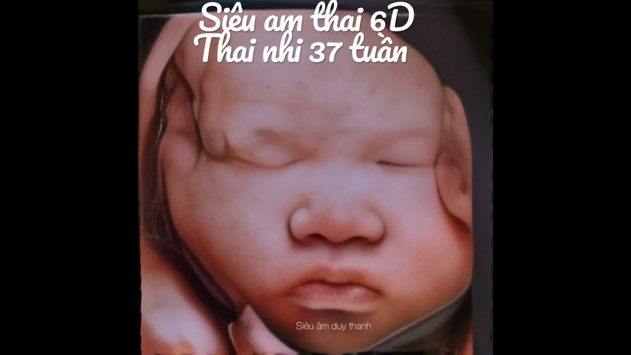 Máy Siêu Âm 6D Tiến Bộ Mới Trong Ngành Y Tế