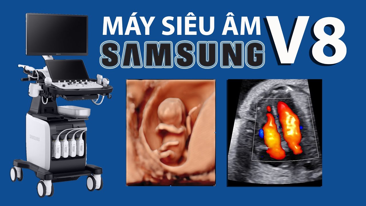 Máy Siêu Âm Samsung V8 Đột Phá Công Nghệ Y Tế