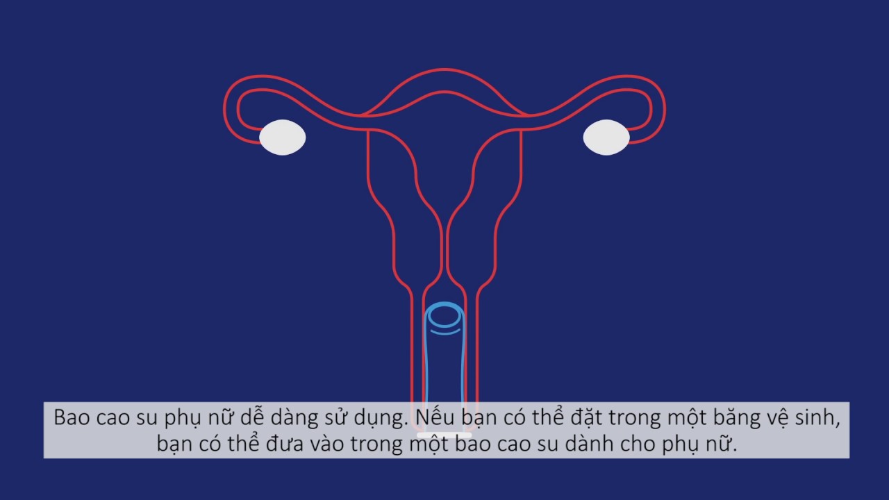 Tìm Hiểu Về Bao Cao Su Nữ Lợi Ích, Cách Sử Dụng và Những Điều Cần Biết