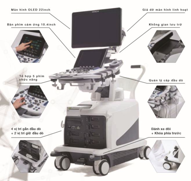 Giá tiền máy siêu âm màu 4D