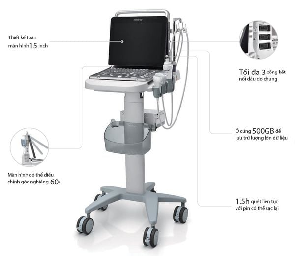 Máy siêu âm tim mạch xách tay giá bao nhiêu