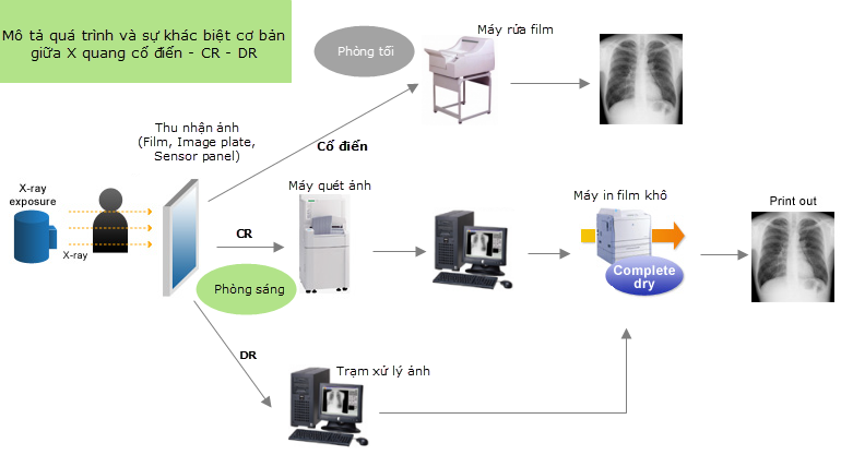 Máy x quang kỹ thuật số